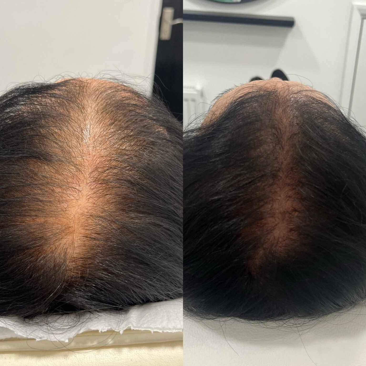 Regenerative Treatments in Ruislip